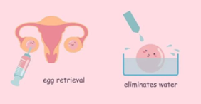 供卵宝宝神经性尿频的应对策略