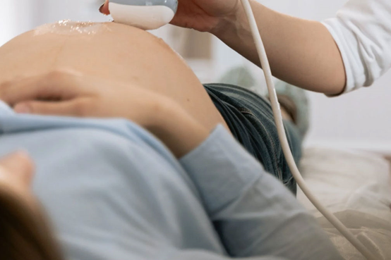 四维彩超检查中供卵宝宝不配合的应对策略 四维彩超检查中供卵宝宝不配合的应对策略